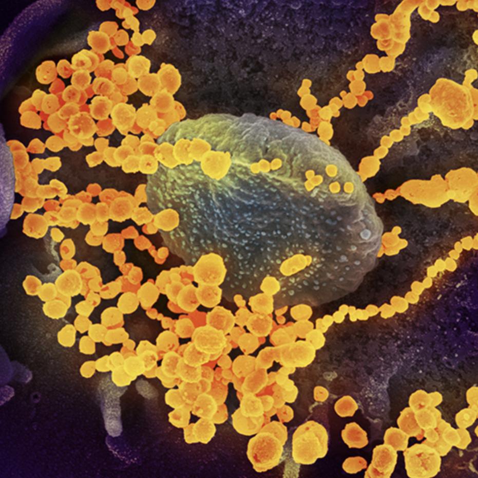 Image of SARS-CoV-2 virus surrounding a cell